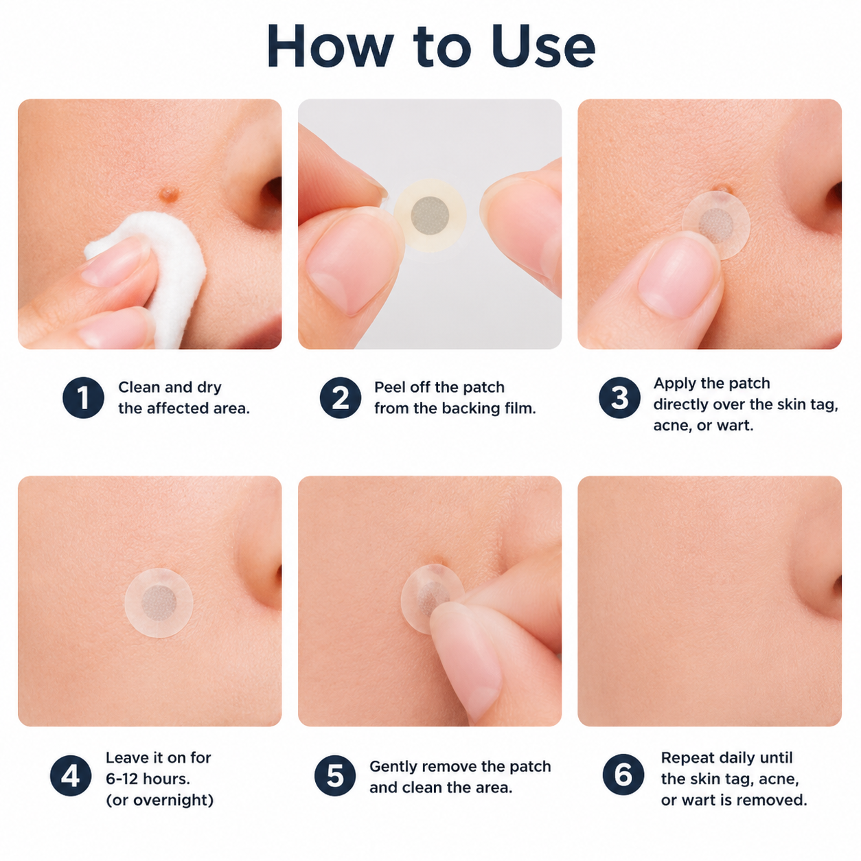 ✨NATRAVOR®2-in-1 Microneedle & Hydrocolloid Patch🍀| Removes Raised Moles, Acne, Flat Warts & Skin Tags | Helps Improve Wrinkles, Scars & Blemishes | Invisible Patches for Face & Body