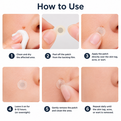 ✨NATRAVOR®2-in-1 Microneedle & Hydrocolloid Patch🍀| Removes Raised Moles, Acne, Flat Warts & Skin Tags | Helps Improve Wrinkles, Scars & Blemishes | Invisible Patches for Face & Body