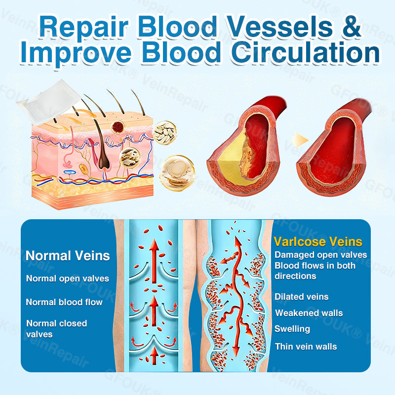 🏙️NATRAVOR® VeinRepair Microneedle Patch Roll⚡Instant Relief, Long-Term Results