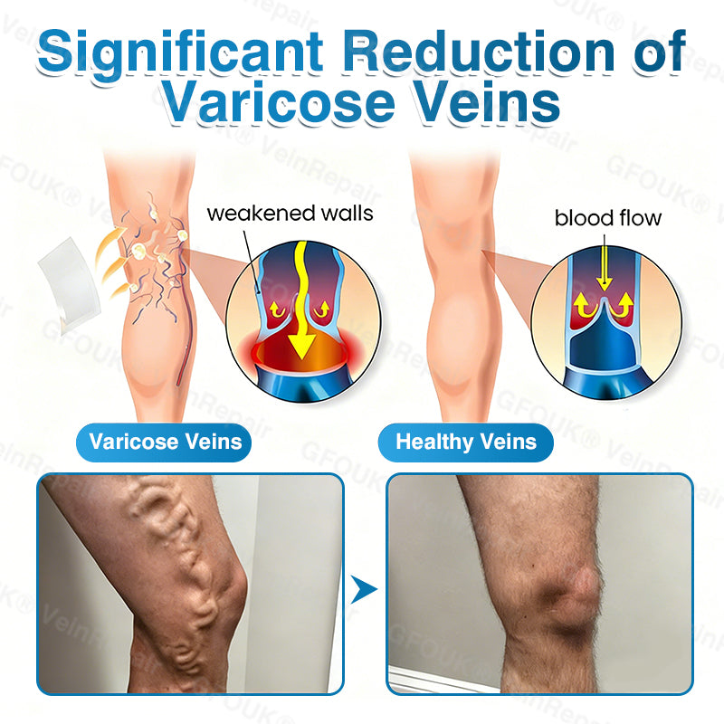 🏙️NATRAVOR® VeinRepair Microneedle Patch Roll⚡Instant Relief, Long-Term Results