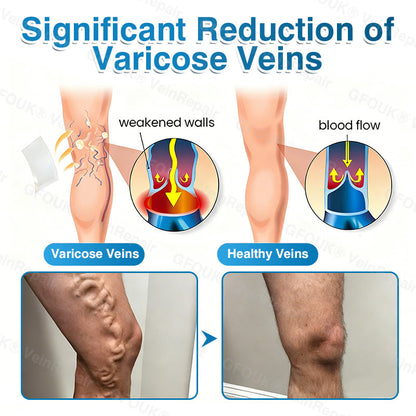 🏙️NATRAVOR® VeinRepair Microneedle Patch Roll⚡Instant Relief, Long-Term Results