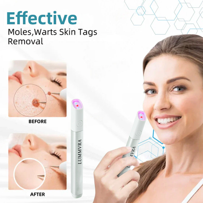✨ Lummvra™ All-in-One CO₂ Laser Eraser Pen | Removes Moles, Warts, Skin Flaws & Pigmentation