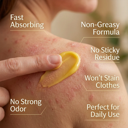 🌿Herbal Psoriasis & Eczema Relief Skin Cream