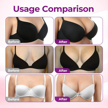 🔥Ends Tonight: 50% OFF🔥Lummvra® Targeted Breast Enhancement Advanced Nano Microneedle Patch