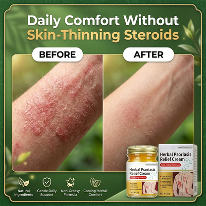 🌿Herbal Psoriasis & Eczema Relief Skin Cream