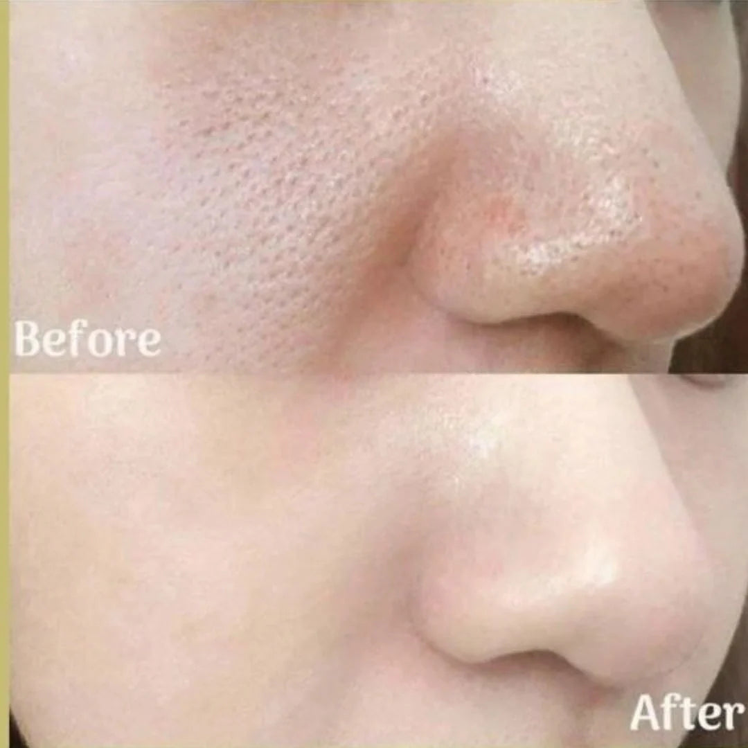 Retinal Shot Tightening Booster (15 ml)