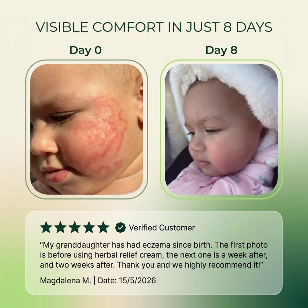 🌿Herbal Psoriasis & Eczema Relief Skin Cream