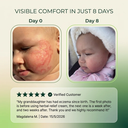 🌿Herbal Psoriasis & Eczema Relief Skin Cream