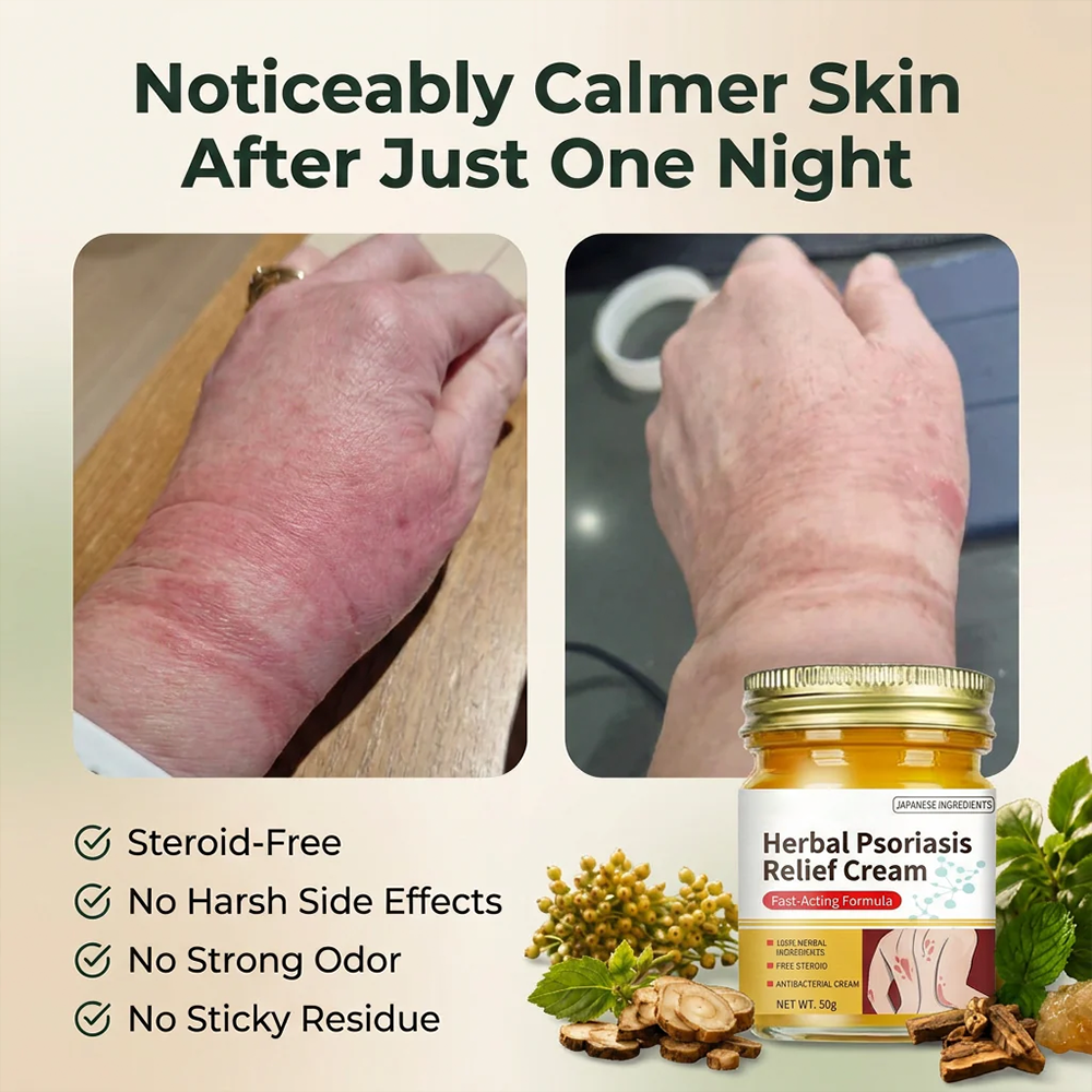 🌿Herbal Psoriasis & Eczema Relief Skin Cream