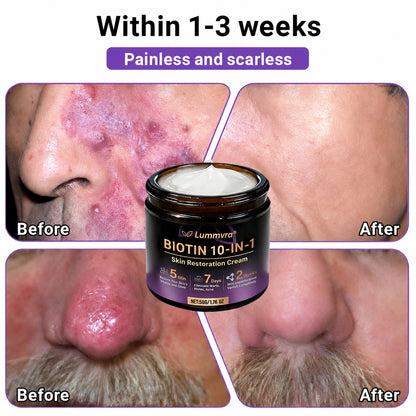 Made and Shipped from Canada ✨Lummvra® Biotin 10-in-1 Skin Restoration Cream