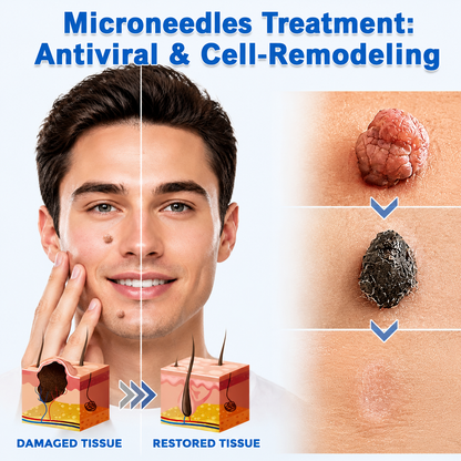 ✨NATRAVOR®2-in-1 Microneedle & Hydrocolloid Patch🍀| Removes Raised Moles, Acne, Flat Warts & Skin Tags | Helps Improve Wrinkles, Scars & Blemishes | Invisible Patches for Face & Body