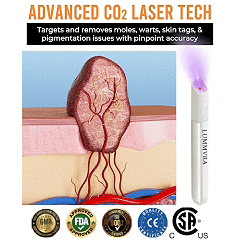 ✨ Lummvra™ All-in-One CO₂ Laser Eraser Pen | Removes Moles, Warts, Skin Flaws & Pigmentation