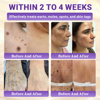 Made and Shipped from Canada ✨Lummvra® Biotin 10-in-1 Skin Restoration Cream