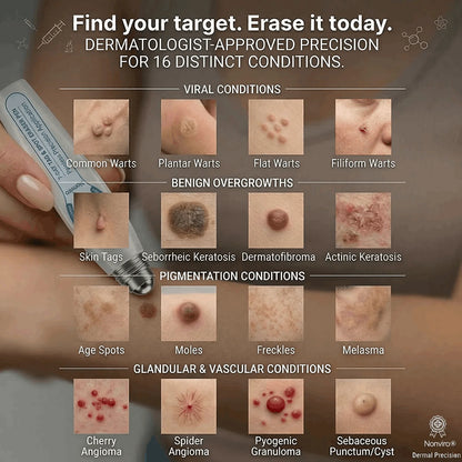 𝐎𝐟𝐟𝐢𝐜𝐢𝐚𝐥 𝐁𝐫𝐚𝐧𝐝 𝐒𝐭𝐨𝐫𝐞 |🖊️Nonviro® 7-𝐷𝑎𝑦 𝗧𝐚𝐠 & 𝗦𝗽𝐨𝐭 𝐄𝐫𝒂𝒔𝒆𝒓(Zero Pain, Zero 𝐒𝐜𝐚𝒓𝒔 Rollerball)🖊️✨