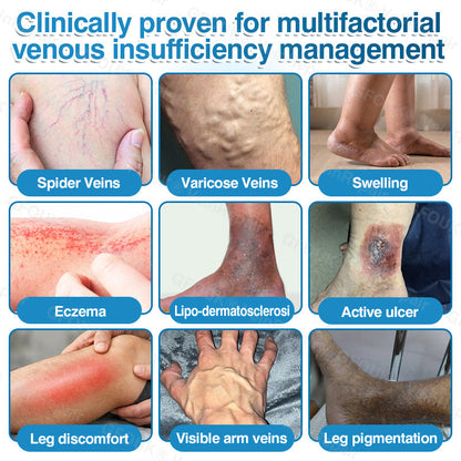 🏙️NATRAVOR® VeinRepair Microneedle Patch Roll⚡Instant Relief, Long-Term Results