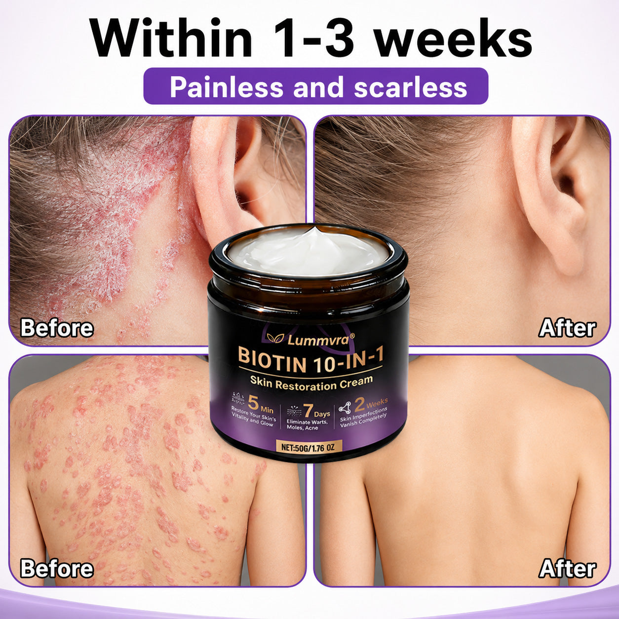 Made and Shipped from Canada ✨Lummvra® Biotin 10-in-1 Skin Restoration Cream