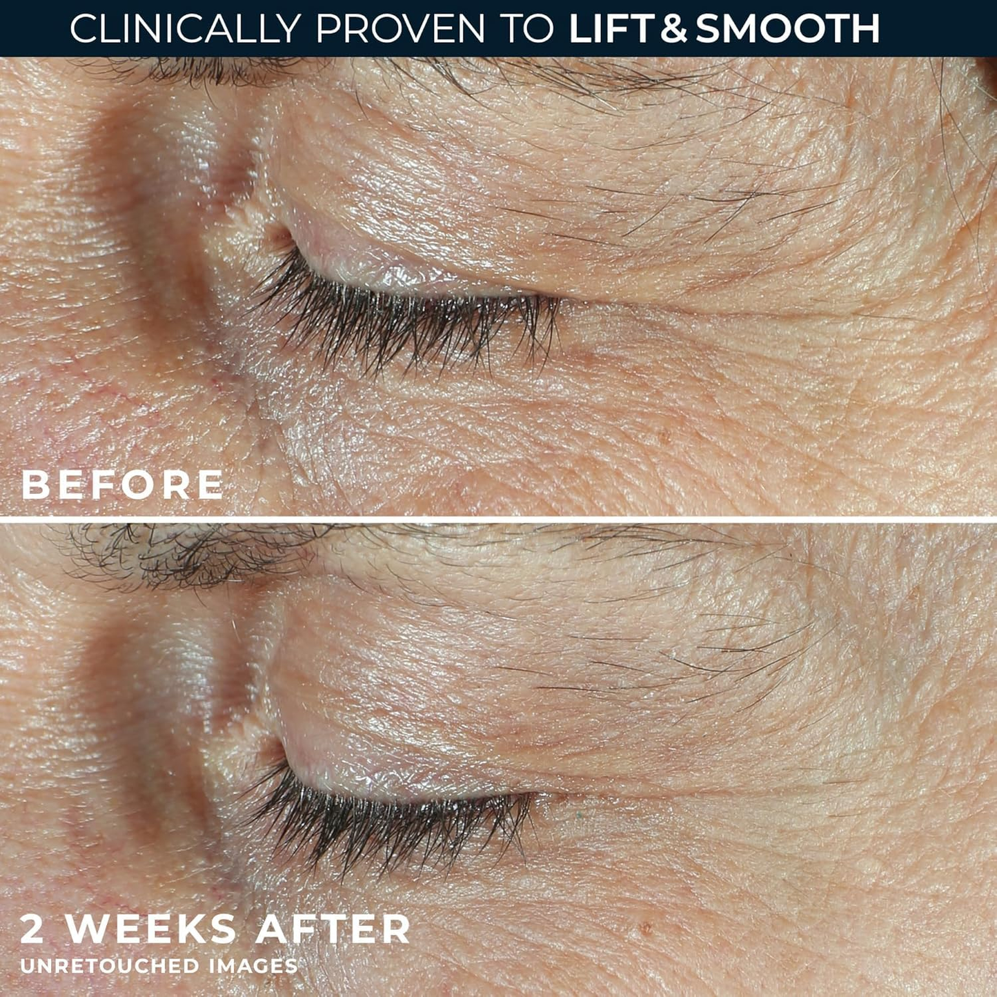 Eye Cream For Face And Neck Retinal, Peptide,Wrinkles, Fine Lines, Aging Skin