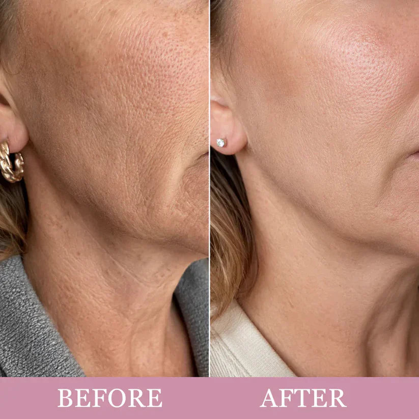 PDRN Collagen Gua Sha Neck Wrinkle Cream