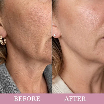 PDRN Collagen Gua Sha Neck Wrinkle Cream