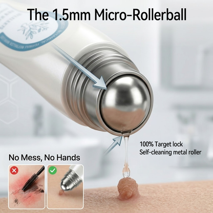 𝐎𝐟𝐟𝐢𝐜𝐢𝐚𝐥 𝐁𝐫𝐚𝐧𝐝 𝐒𝐭𝐨𝐫𝐞 |🖊️Nonviro® 7-𝐷𝑎𝑦 𝗧𝐚𝐠 & 𝗦𝗽𝐨𝐭 𝐄𝐫𝒂𝒔𝒆𝒓(Zero Pain, Zero 𝐒𝐜𝐚𝒓𝒔 Rollerball)🖊️✨